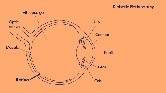diabetic retinopathy treatment dogs